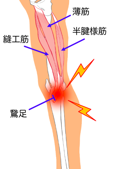 鵞足