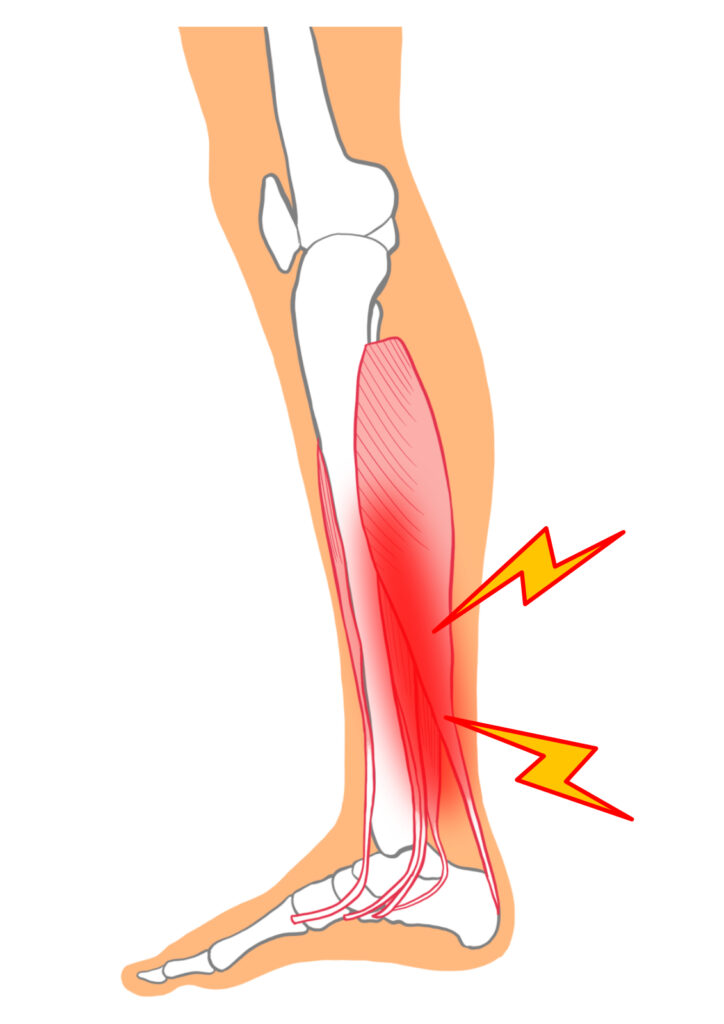 足の筋肉